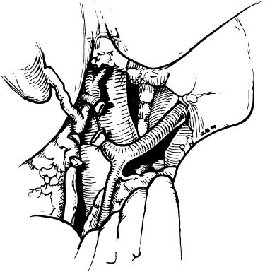 FIGURE 45-3