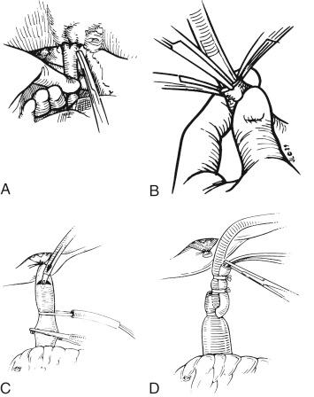 FIGURE 45-5