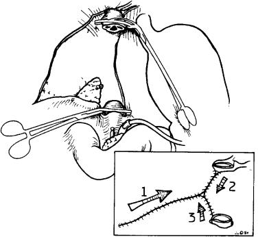 FIGURE 45-10