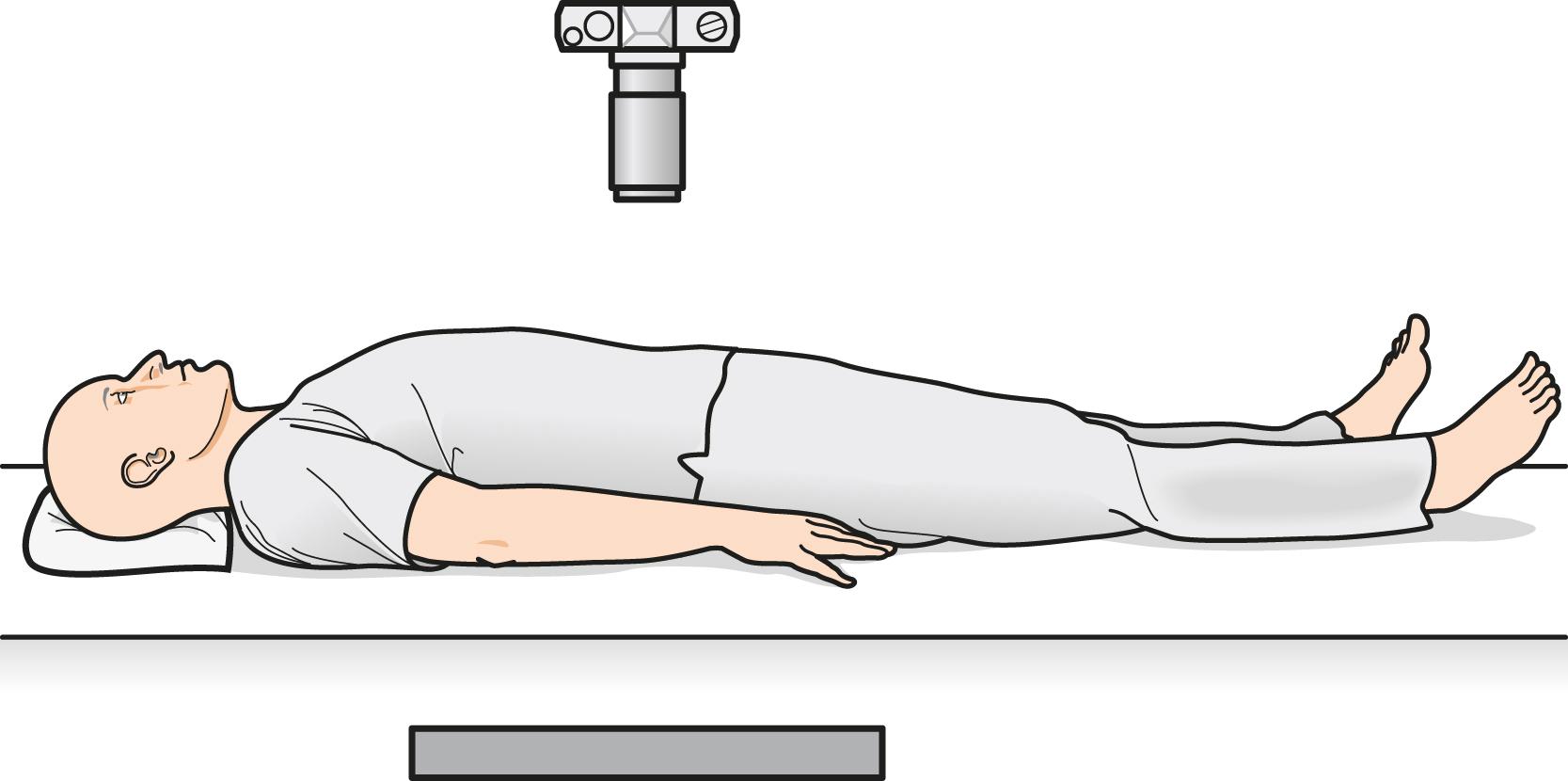 Fig. 12.10, Positioning for Supine View of the Abdomen.