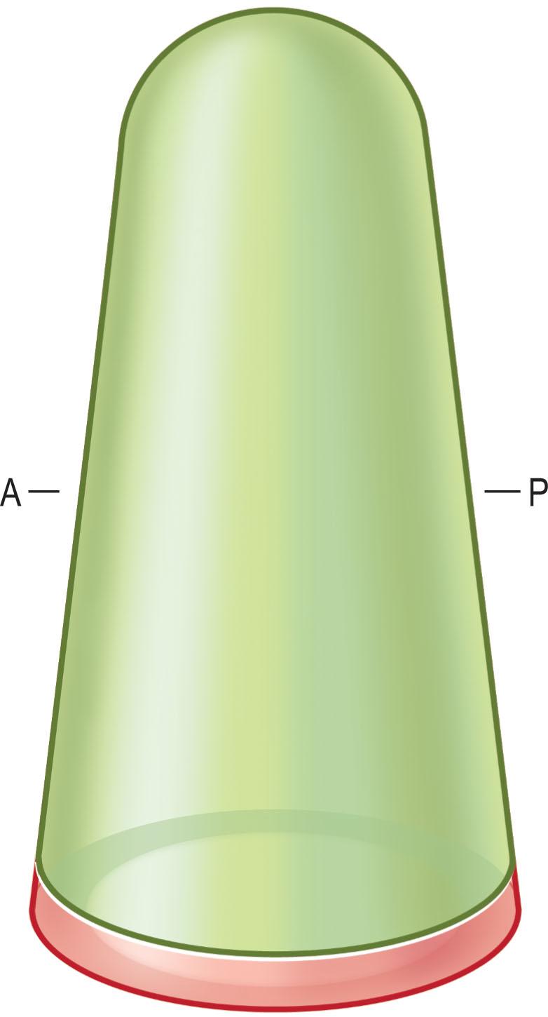 Figure 15.1, Vaginal vault. A, anterior; P, posterior.