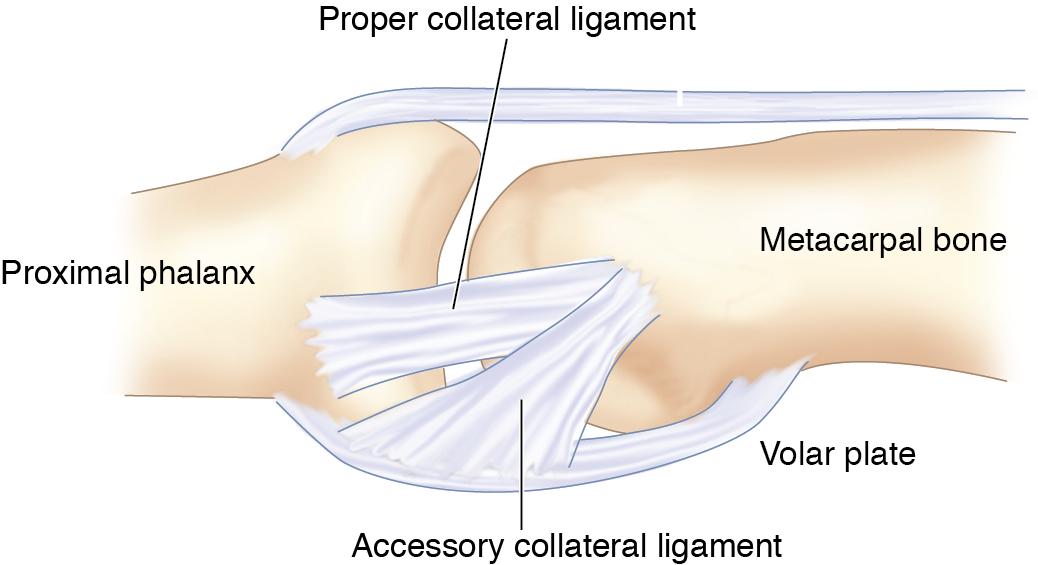 FIGURE 17.3, Ulnar collateral ligament (UCL) anatomy.