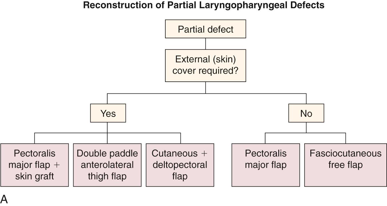 Fig. 103.2, (A) Decision tree for partial pharyngeal defects. Note that the decision tree does not include a decision point for patients who have salvage surgery after chemoradiation therapy and undergo primary closure of the pharynx. For these patients, a vascularized pharyngeal interposition graft is suggested to support the primary pharyngeal closure. (B) Decision tree for total pharyngeal defects.