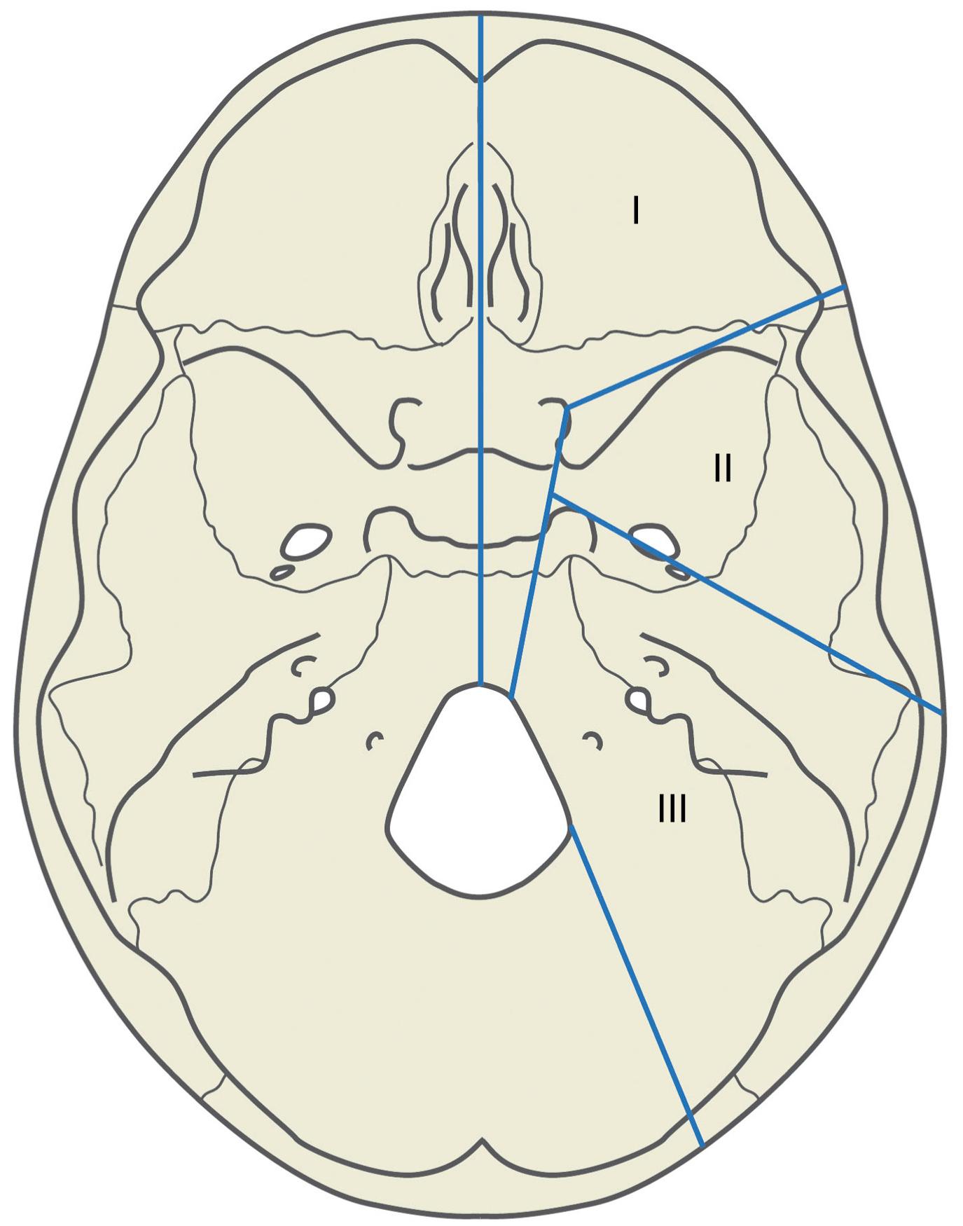 Fig. 27.1, Skull base regions.