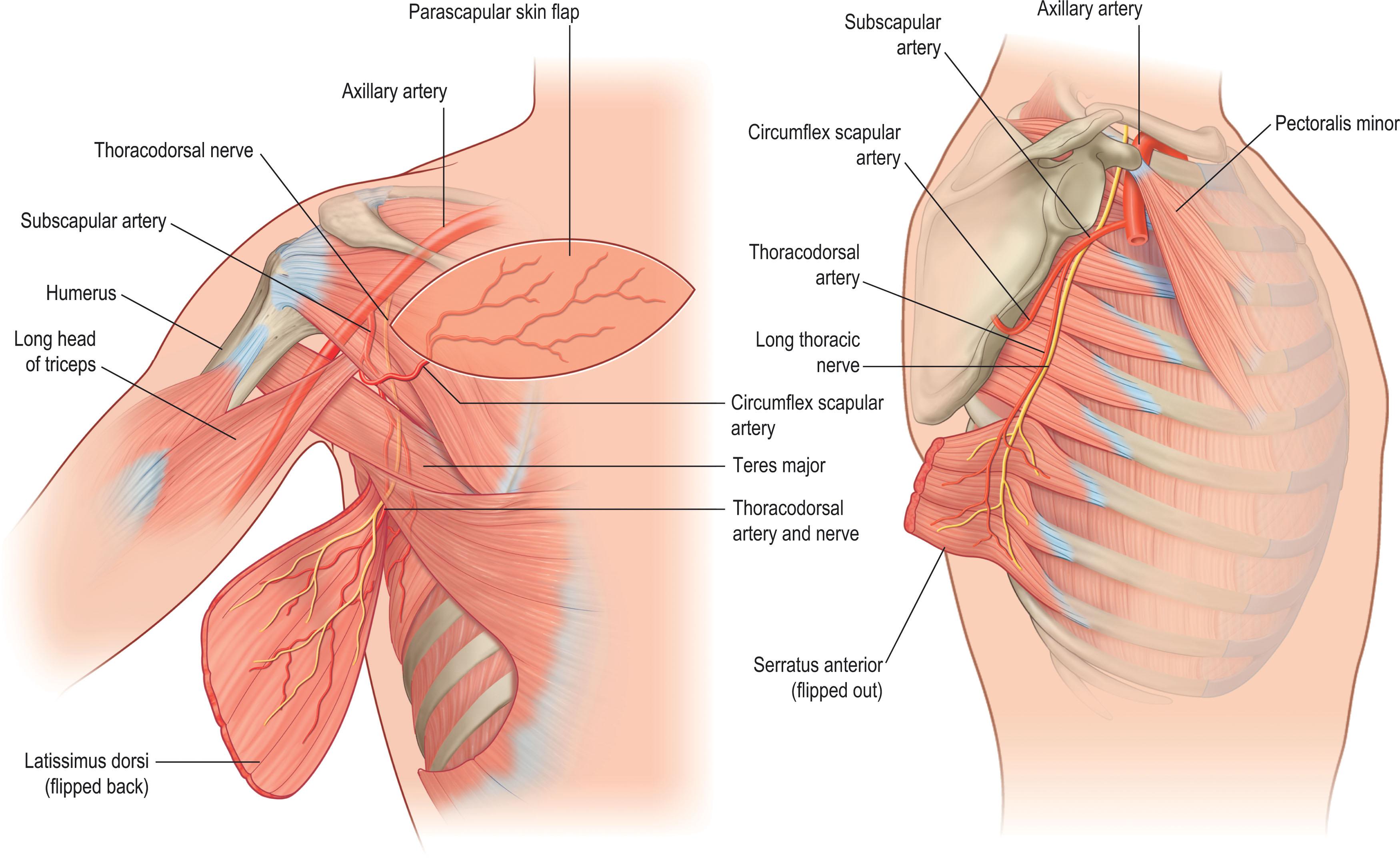 Figure 12.13, Subscapular system. The subscapular system is the origin of the axial blood supply for many flaps within the upper thoracic and middle thoracic posterior trunk region. This anatomical relationship can be exploited in the creation of large chimeric flaps that can be raised on a single pedicle.