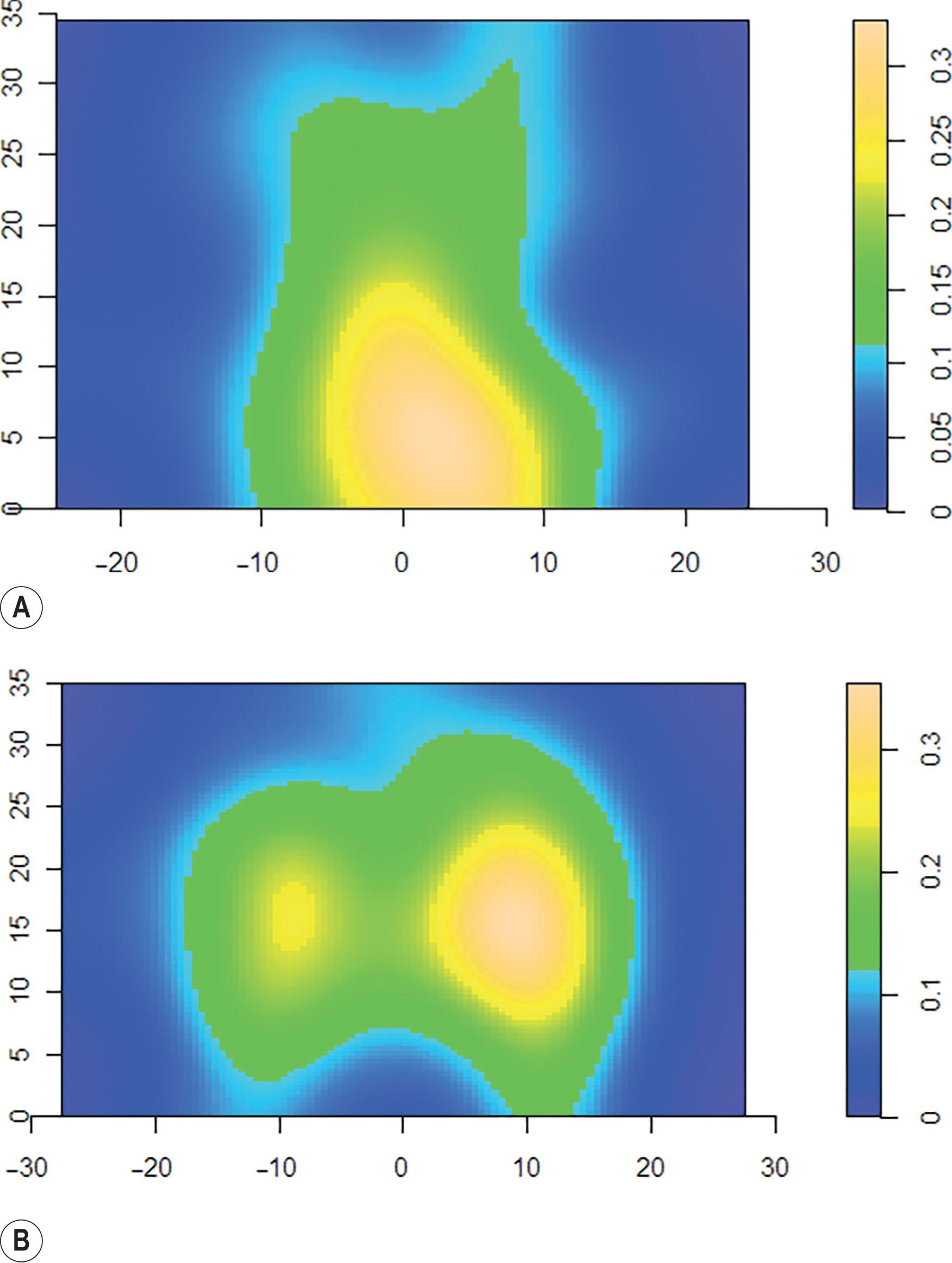 Figure 12.8, Heat map of posterior trunk perforator density. The “heat map” image below represents the density of perforators contained in the (A) thoracic and (B) lumbar regions of the posterior trunk.