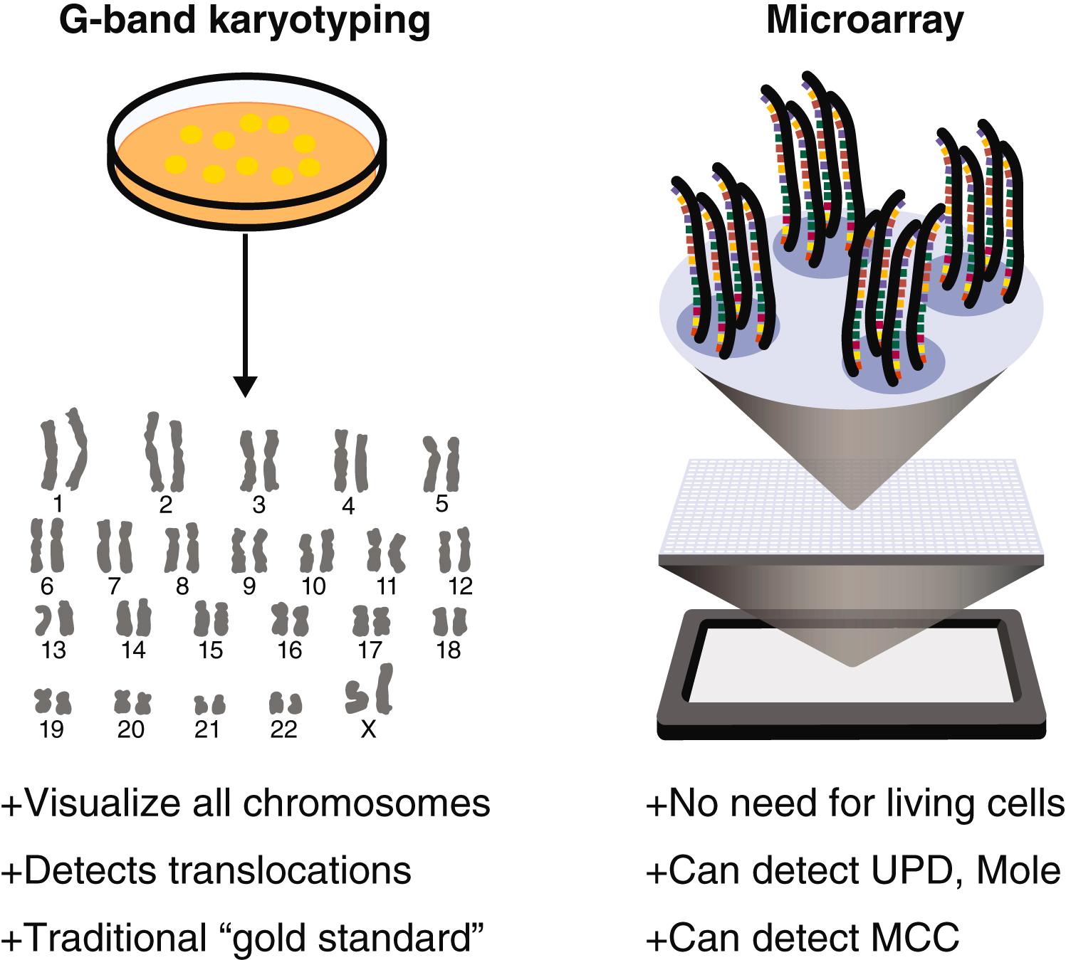 Fig. 28.3, Traditional G-band karyotyping compared with comprehensive microarray analysis.