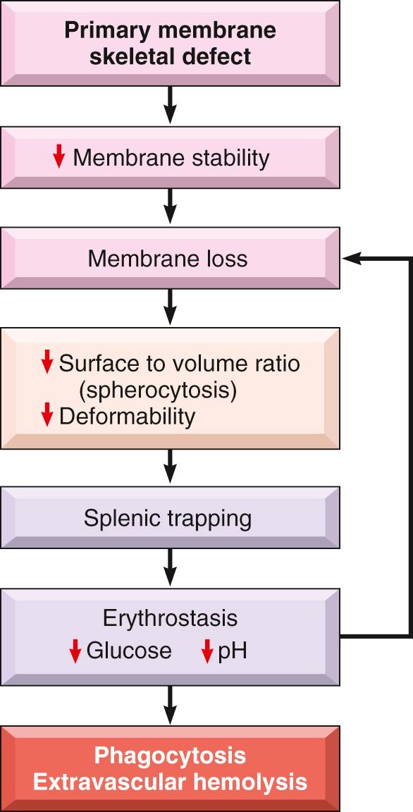 Figure 14.3, Pathophysiology of hereditary spherocytosis.