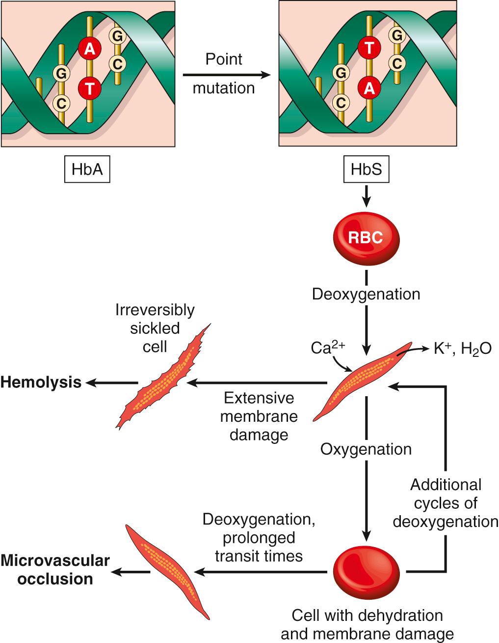 Figure 14.7, Pathophysiology of sickle cell disease. HbA, Hemoglobin A; HbS, hemoglobin S; RBC, red blood cell.