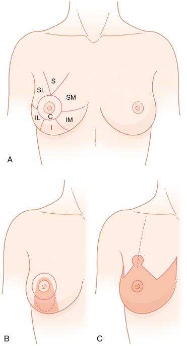 Fig. 8.1, Stock figure showing circumvertical and inverted T patterns.