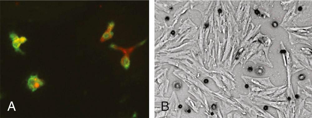 FIGURE 101-3, Endothelial progenitor cells (EPCs) and mesenchymal stem cells (MSCs) in culture. A, EPCs from the peripheral blood mononuclear cell layer, cultured on fibronectin for 4 days. Adherent cells (CD34 +/– , VEGFR-2 + ) typically take up the markers lectin and DiI-Oxidized Low Density Lipoprotein. B, MSCs cultured from human bone marrow yielding a population of adherent MSCs that characteristically express the antigens CD29 and CD44 but are negative for the hematopoietic cell marker CD45.