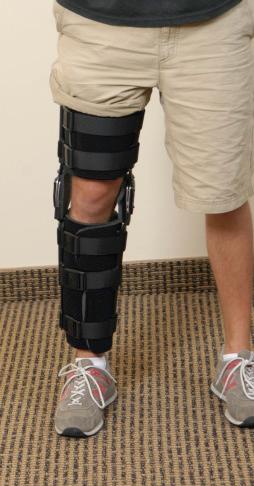 FIG 11-4, A long-leg postoperative brace protects the patient during weight bearing in the event of a fall and promotes early, comfortable weight bearing during the first few postoperative weeks.