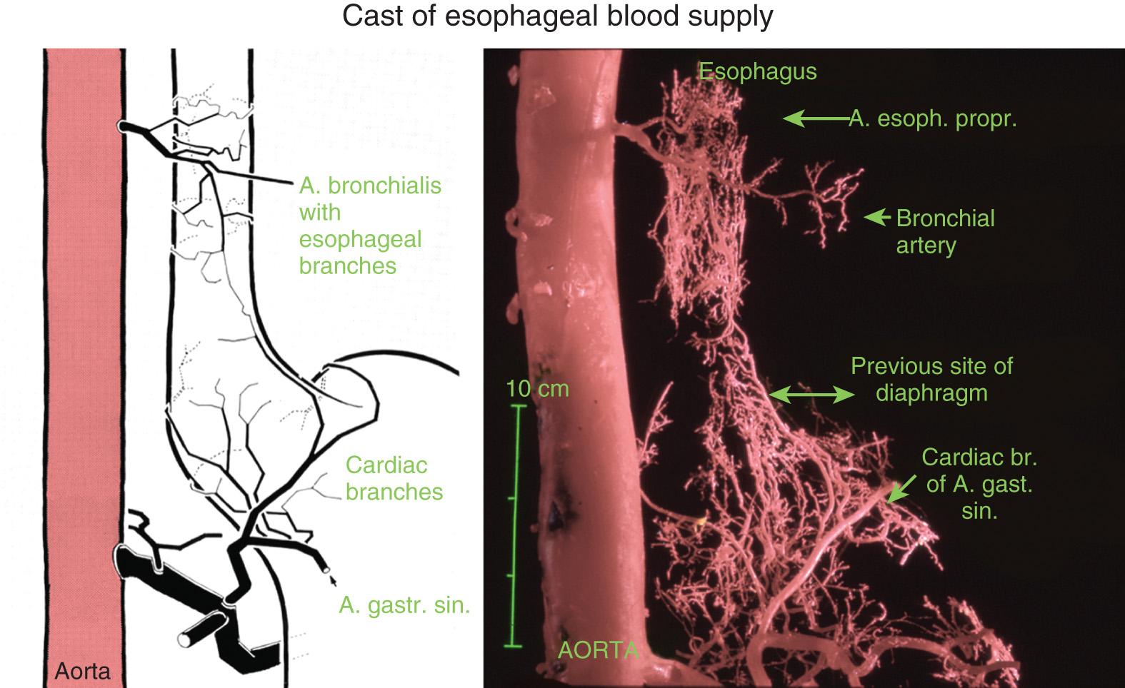 FIGURE 4.9, Arterial cast showing the vascular supply to the middle and lower esophagus. There is a rich intramural network of small vessels, allowing the mobilized esophagus to remain well perfused, even after extensive mobilization.