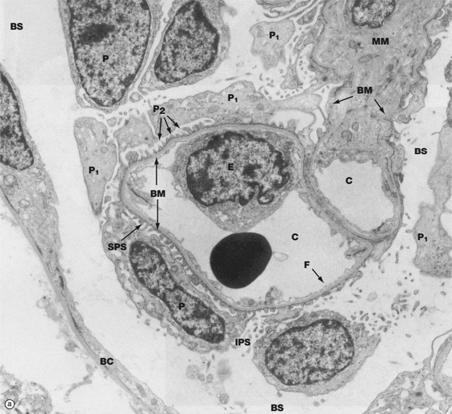 Fig. 17.4, Electron micrograph of glomerulus.