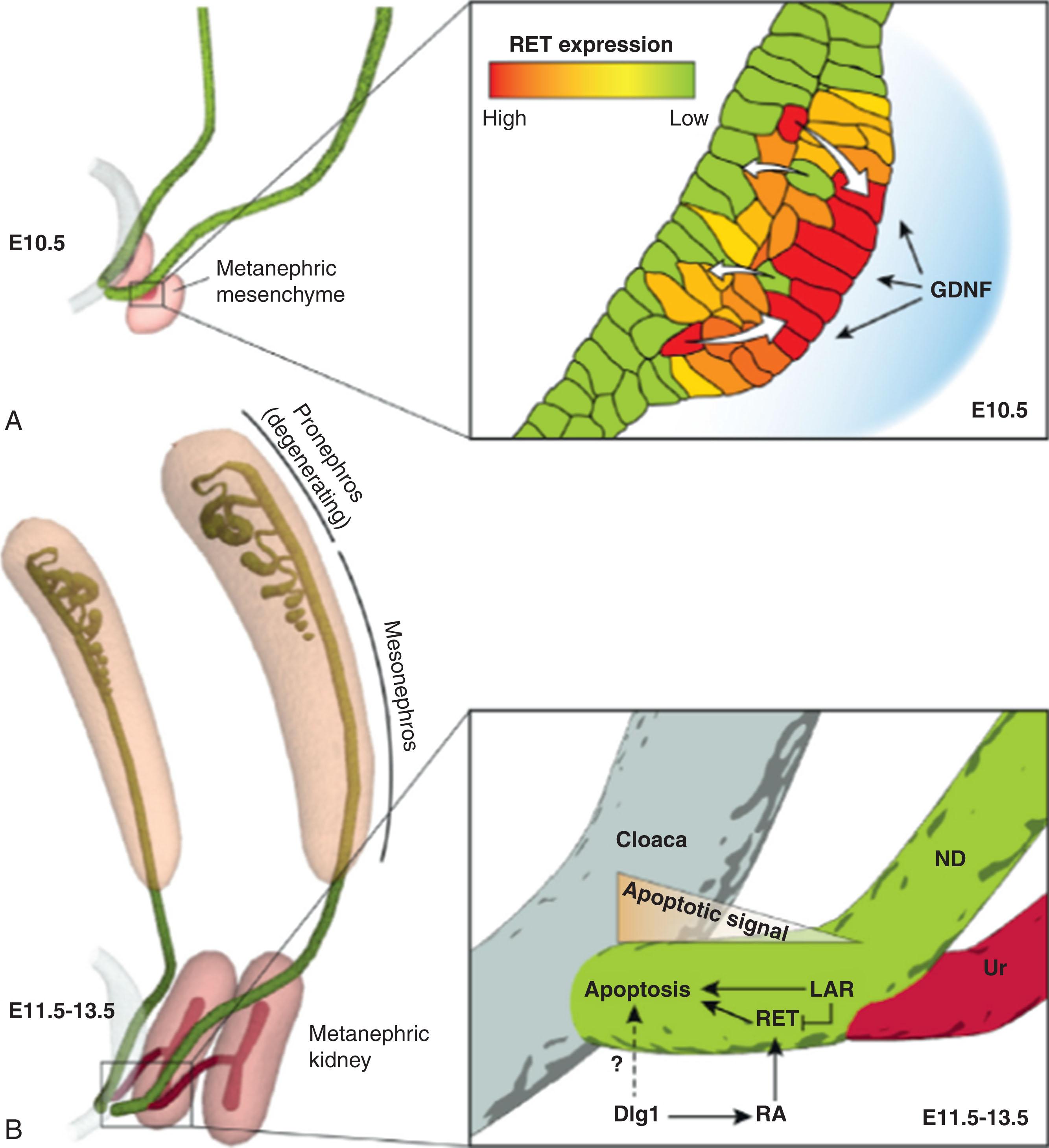 Fig. 74.2, Interaction between mesenchymal and nephric duct epithelial tissues drives cell sorting to form the ureteric bud and programmed cell death during ureter maturation. (A) Ureteric bud evagination involves RET tyrosine kinase–dependent cell sorting (white arrows) to assemble the highest RET-responsive cells toward glial cell–derived neurotropic factor ( GDNF ) secreted from the metanephric mesenchyme. (B) A graduated apoptotic signal drives elimination of the common nephric duct. Apoptotic cell death involves Dlg1 and retinoic acid ( RA ) signaling from the mesenchymal compartment, which appear to act through RET within the common nephric duct. Apoptosis additionally requires the expression of LAR-family receptor protein tyrosine phosphatases in the common nephric duct, which act partially by downregulating RET prosurvival signaling. E , Embryonic day; ND , nephric duct; Ur , ureter.