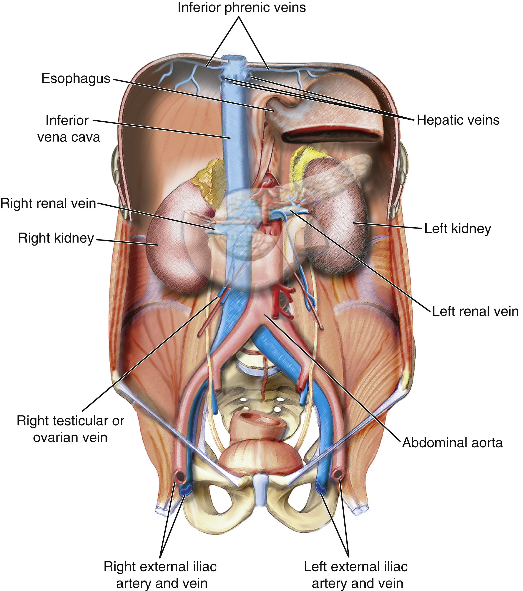 Fig. 30.3, Inferior vena cava.