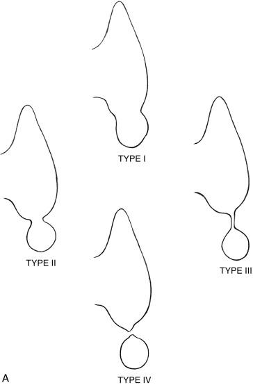 Fig. 9.5, Thyroid Rests.