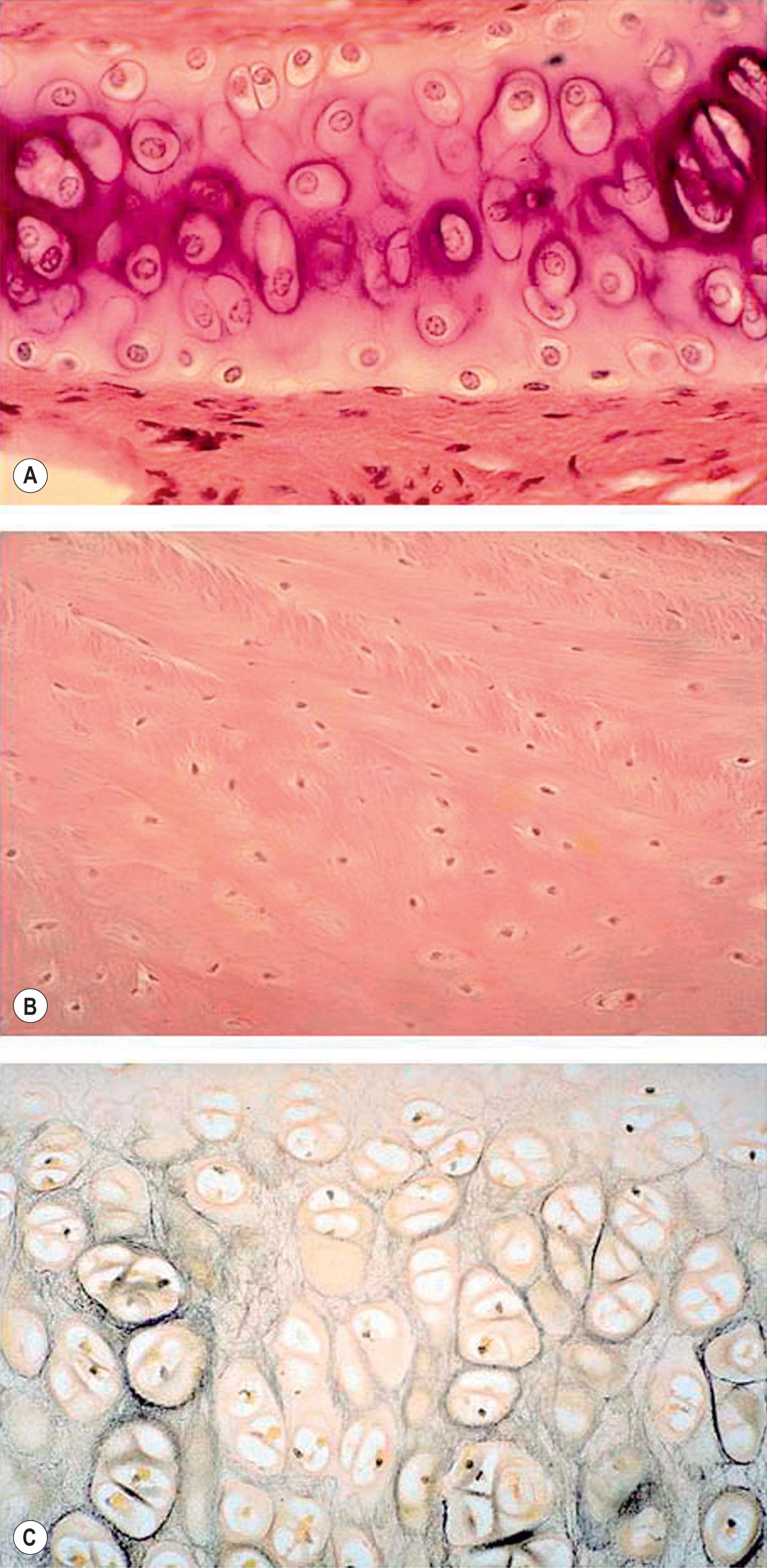 Figure 19.1, Histology of (A) hyaline cartilage, (B) fibrocartilage, and (C) elastic cartilage (silver staining).