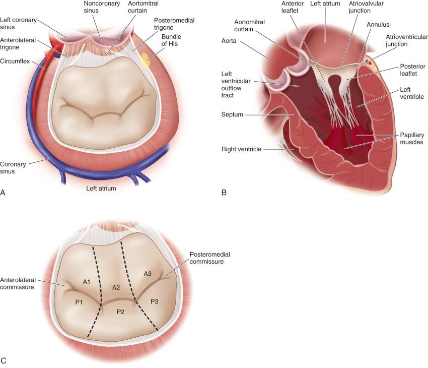 Figure 18.1, (A) Short axis view of the mitral valve (MV) from the atrium. (B) Horizontal long axis cross section of the MV and left ventricle. (C) Mitral valve leaflet nomenclature.