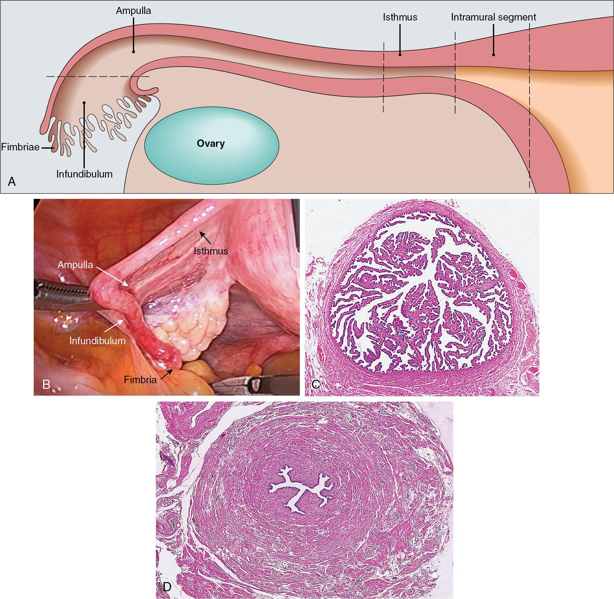 Fig. 3.19, The fallopian tube. A, Schematic representation. Note that the intramural segment is within the uterine body. B, Intraoperative picture of the fallopian tube closely resembling the schematic view. C, Low-power histologic section from the ampulla. D, Section from the isthmus of the tube. Note the thick muscular wall.