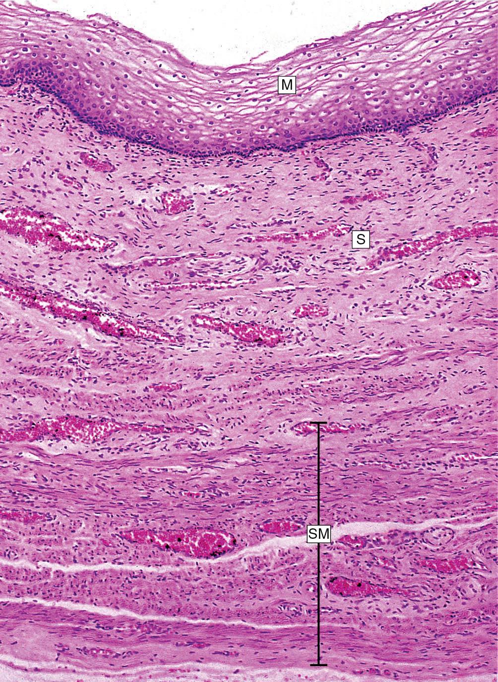 Fig. 3.8, Histologic section of the vaginal squamous epithelium (M). The submucosa (S) is well vascularized (lamina propria). SM, Smooth muscle.