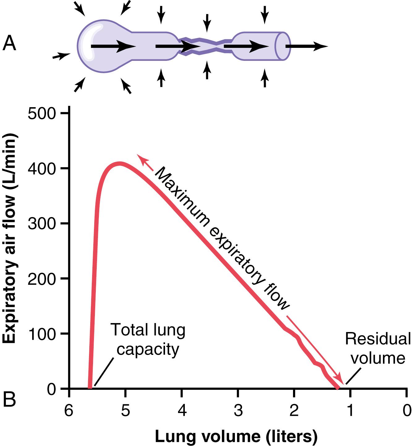 Figure 43-1, A, Collapse of the respiratory passageway during maximum expiratory effort, an effect that limits expiratory flow rate. B, Effect of lung volume on the maximum expiratory airflow, showing decreasing maximum expiratory airflow as the lung volume becomes smaller.