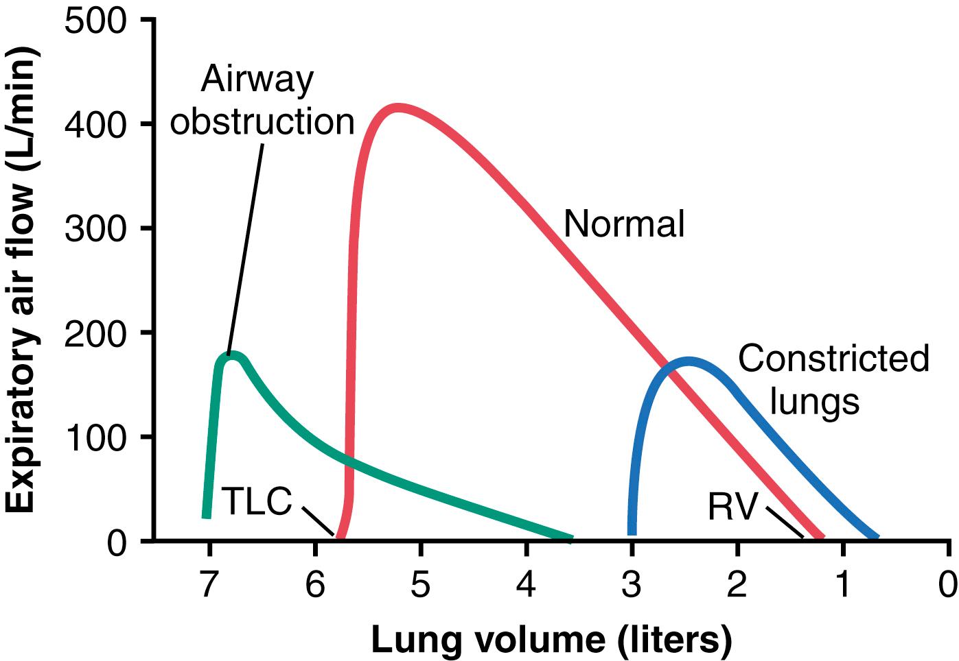 Figure 43-2, Effect of two respiratory abnormalities—constricted lungs and airway obstruction—on the maximum expiratory flow-volume curve. RV, Residual volume; TLC, total lung capacity.