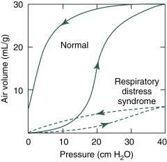Fig. 9.3, Air pressure volume curves of normal and abnormal lung. Volume is expressed as milliliters of air per gram of lung. Lung of infant with respiratory distress syndrome (RDS) accepts smaller volume of air at all pressures. Note that deflation pressure volume curve closely follows inflation curve for the RDS lung.