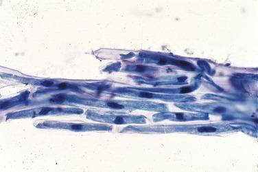 Fig. 2.12, Vegetable Cells (Sputum).