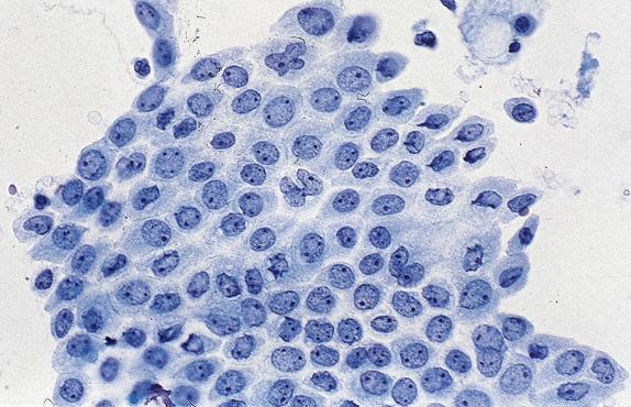 Fig. 2.3, Mesothelial Cells (Fine-Needle Aspiration).