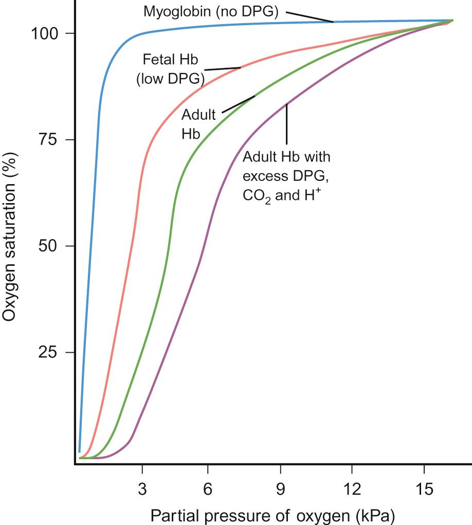 Fig. 17.5, The oxygen dissociation curve for myoglobin, fetal and adult haemoglobin (Hb) and the effect of acidosis, carbon dioxide and 2,3-DPG. Adult Hb (dark green line) unloads most of its oxygen between 6.5 and 2.5 kPa. Fetal Hb unloads its oxygen over a lower range (5.2 and 1.3 kPa). This is partly because fetal Hb does not bind 2,3 DPG efficiently and thus will tend to ‘hold on’ to oxygen at the expense of maternal Hb during pregnancy. Both will still deliver oxygen to the tissues as the tissue store for oxygen is myoglobin whose dissociation curve is even further to the left. If Hb binds oxygen more strongly, then the dissociation curve is shifted to the left. In these circumstances, oxygen is less readily delivered to the tissues. The oxygen dissociation curve is altered by the presence of hydrogen ions (the Bohr effect), 2,3-diphosphoglycerate (2,3-DPG) and carbon dioxide. Increases in these molecules shift the dissociation curve to the right. The net effect of this is that less oxygen remains bound to the Hb molecule at the same partial pressure of oxygen, therefore oxygen tends to be delivered better to areas with higher concentrations of hydrogen ions and carbon dioxide. Newly transfused blood is less efficient at delivering oxygen as it is low in 2,3-DPG.