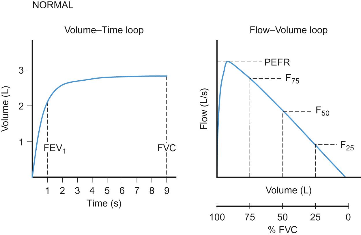 Fig. 17.7, Normal volume–time and flow–volume loops.