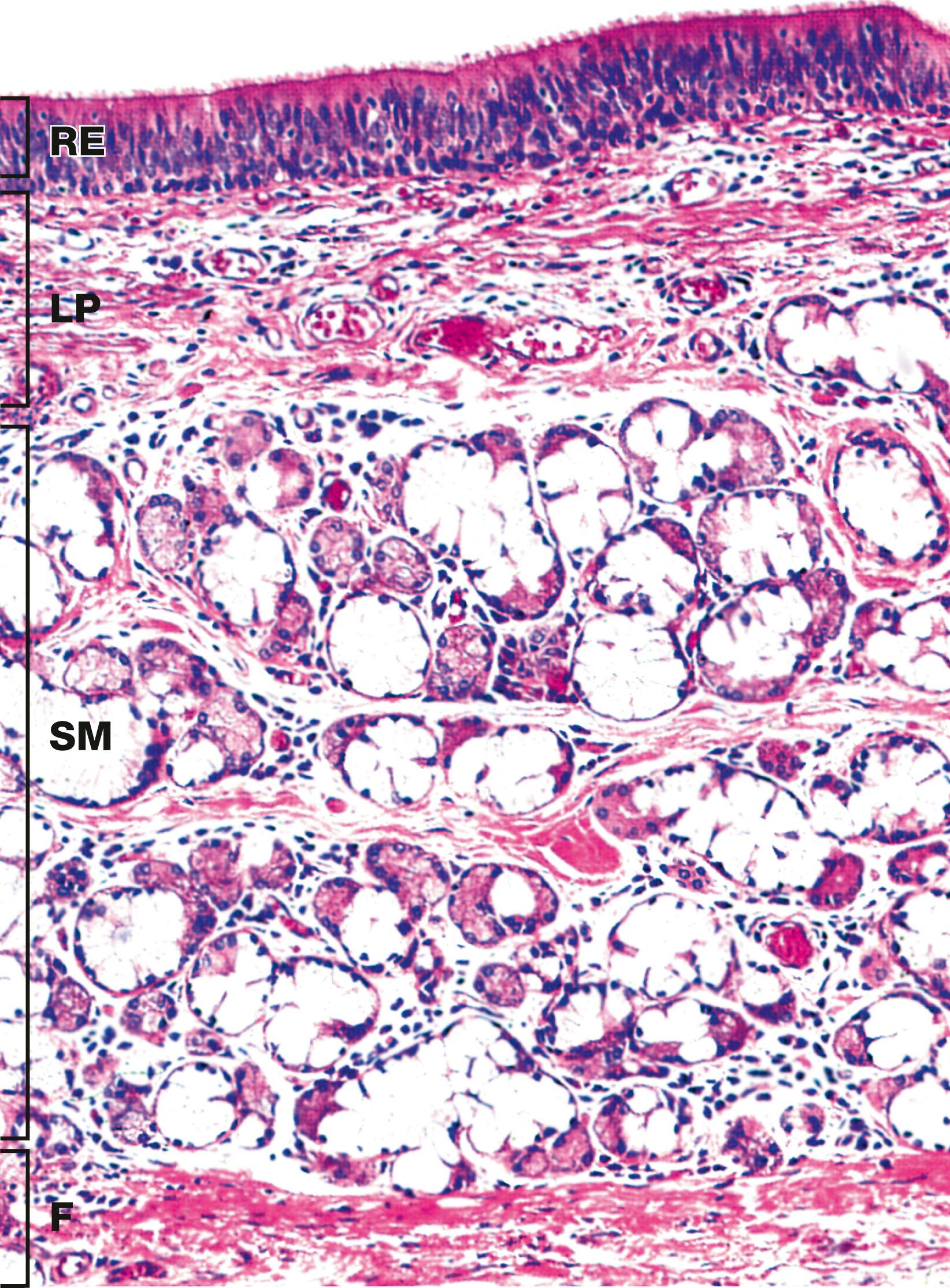 Fig. 12.7, Trachea