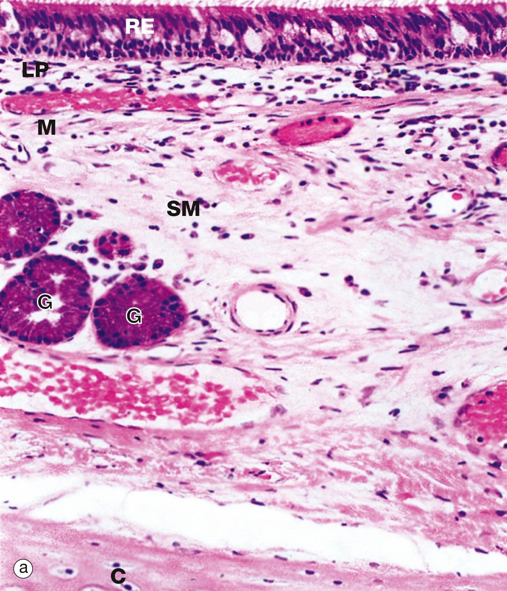 Fig. 12.8, Primary bronchus