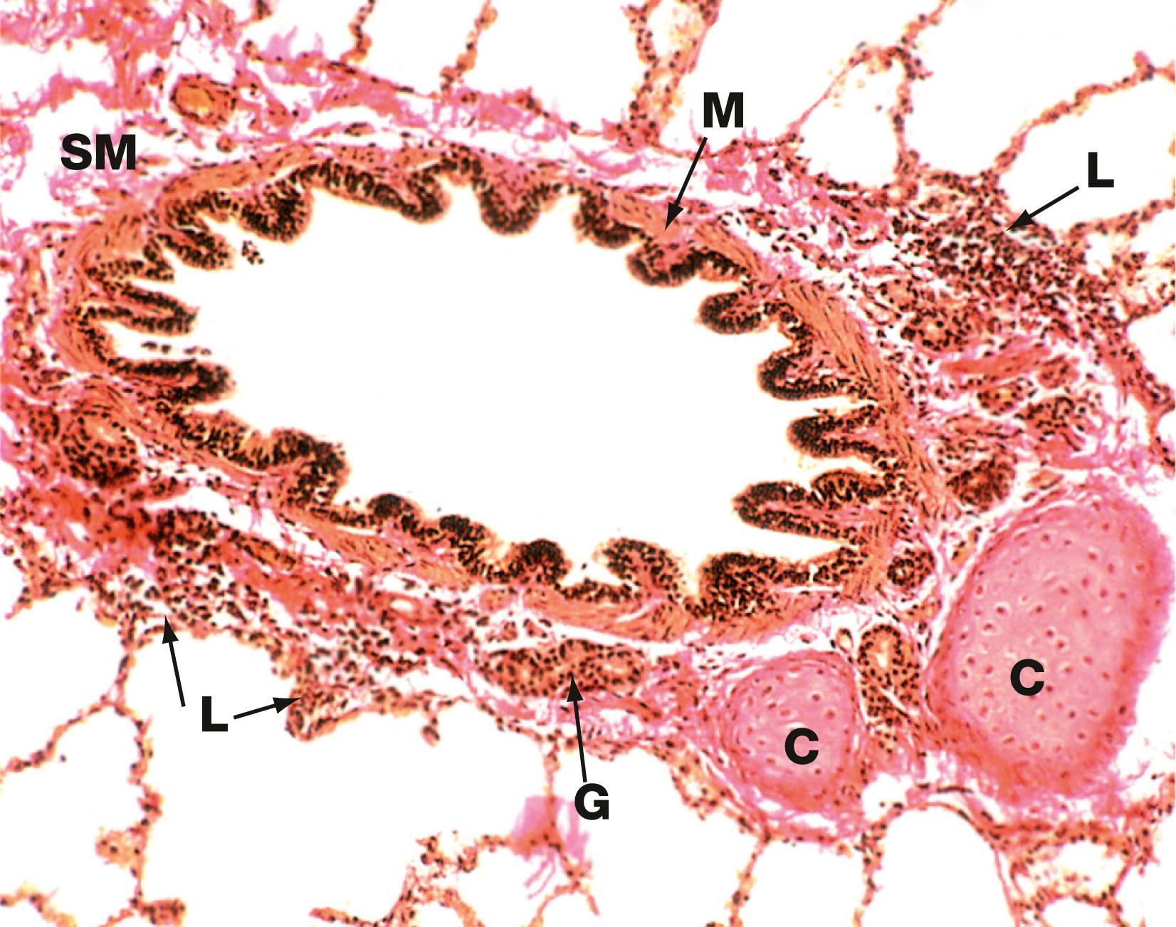 Fig. 12.10, Tertiary (segmental) bronchus