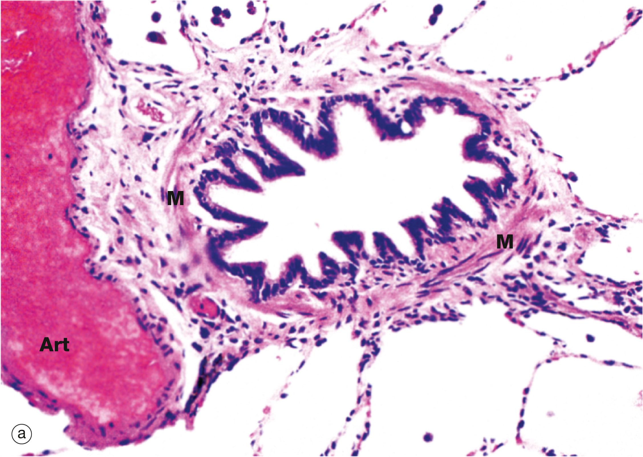 Fig. 12.11, Bronchiole