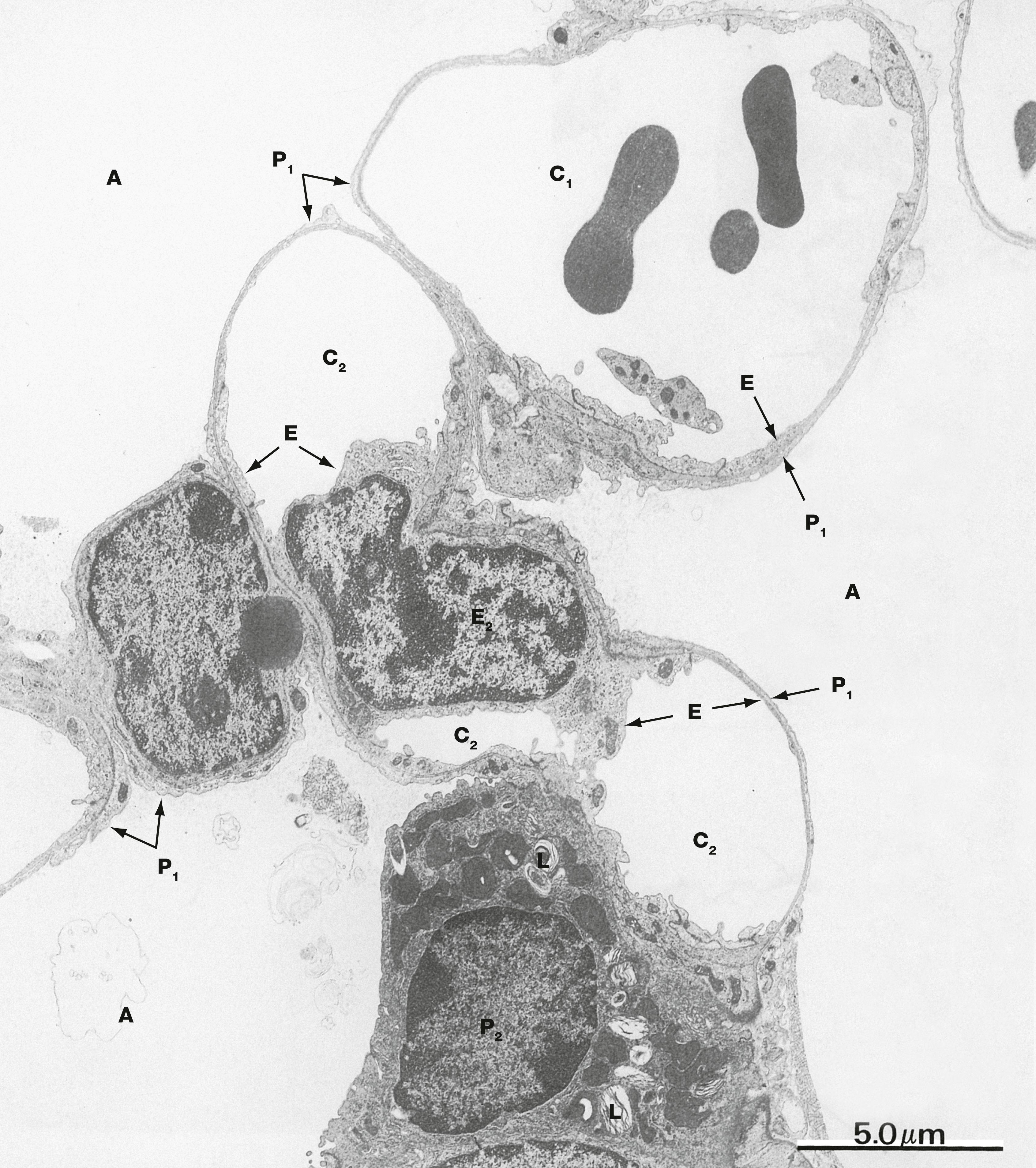 Fig. 12.14, Alveolar wall