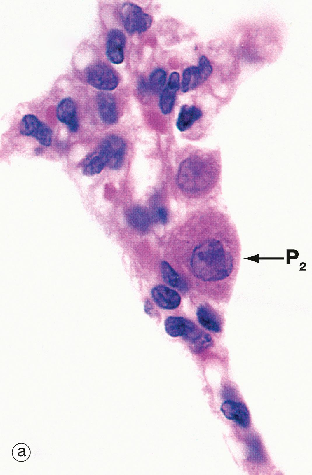 Fig. 12.15, Type II pneumocytes