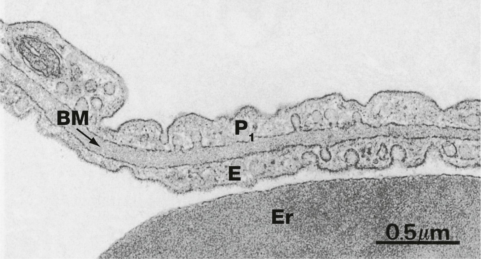 Fig. 12.16, Air–blood barrier