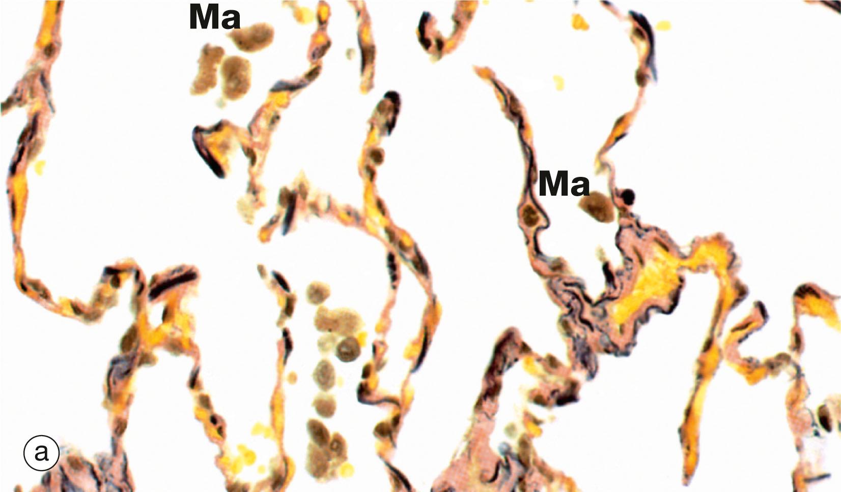 Fig. 12.17, Pulmonary elastic tissue