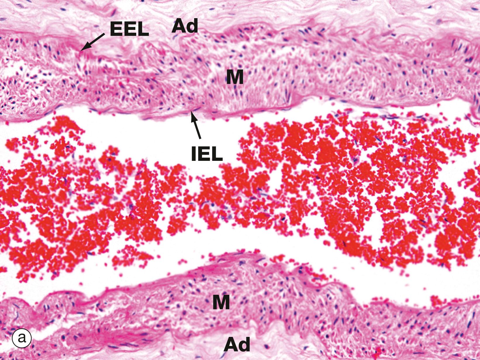 Fig. 12.23, Smaller pulmonary vessels