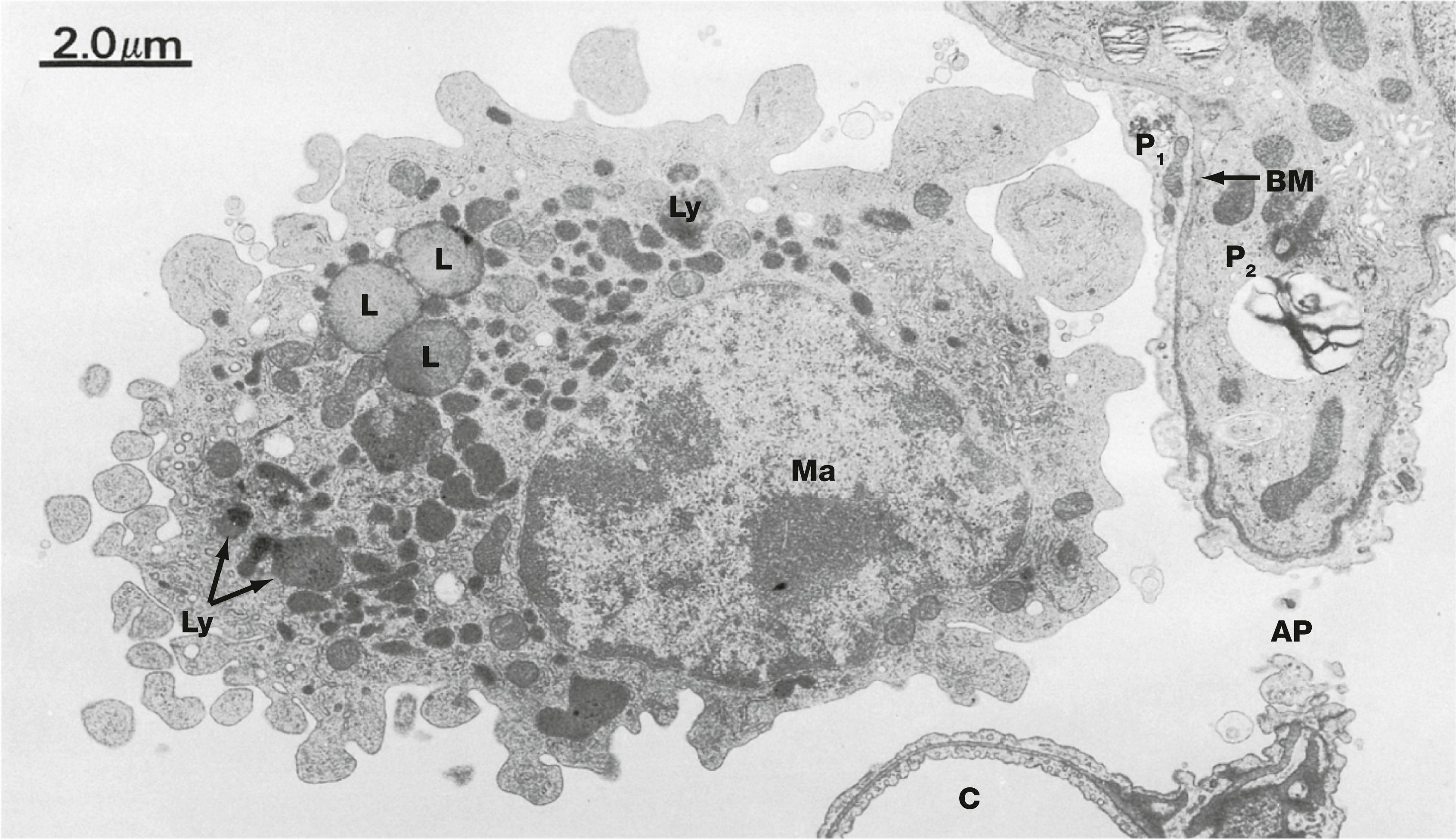 Fig. 12.18, Alveolar macrophage