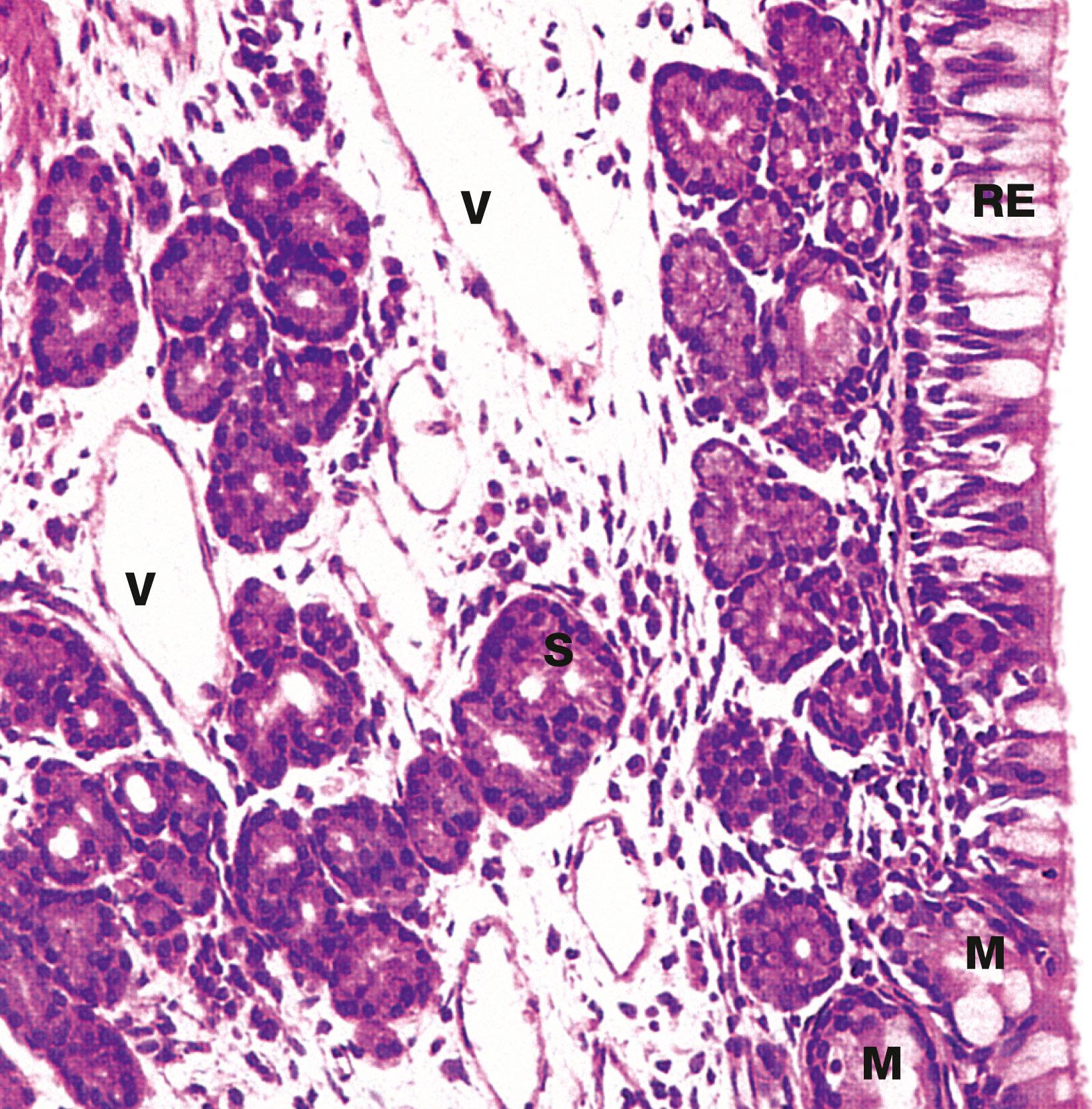Fig. 12.3, Nasal mucosa