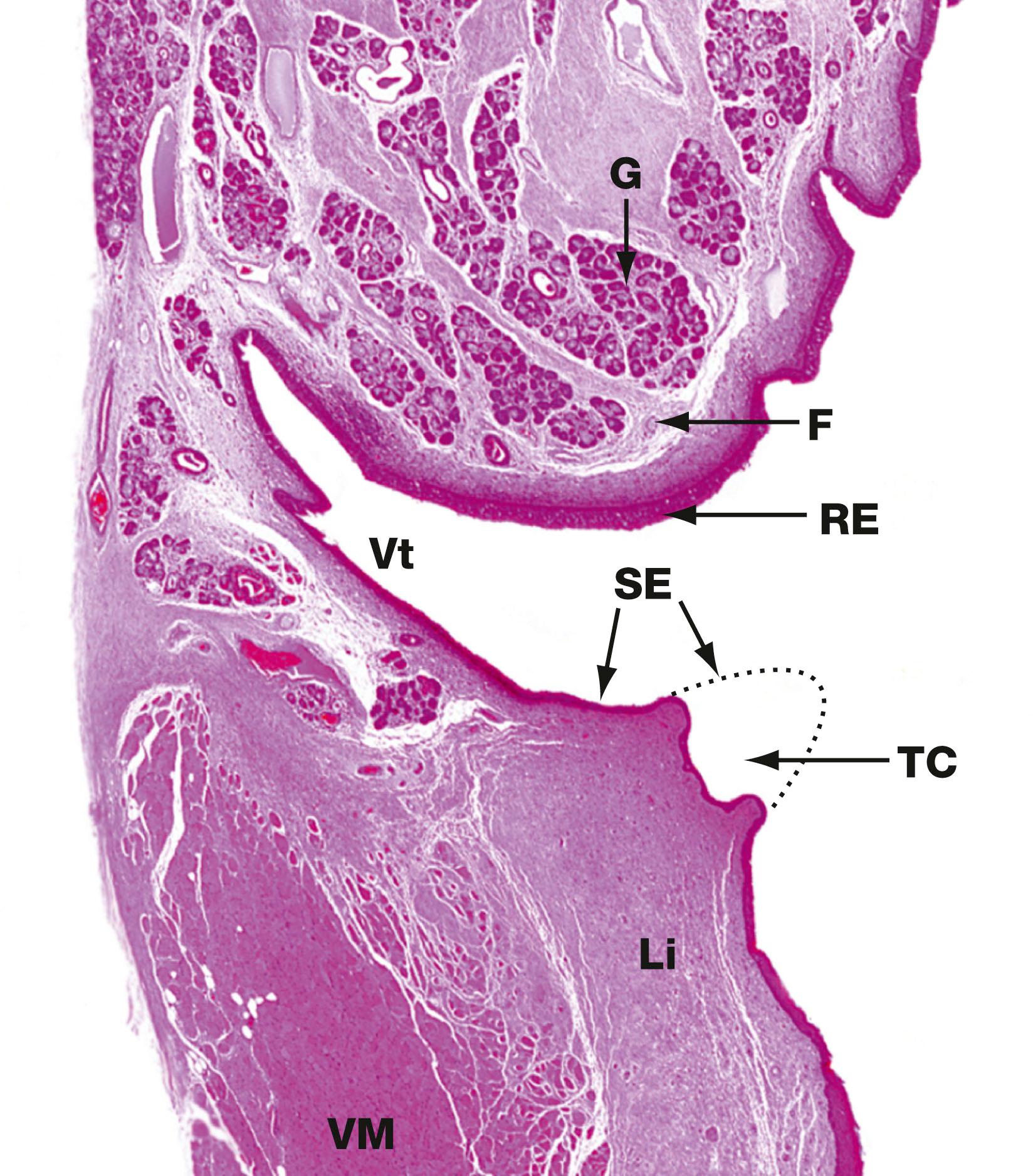 Fig. 12.5, Larynx