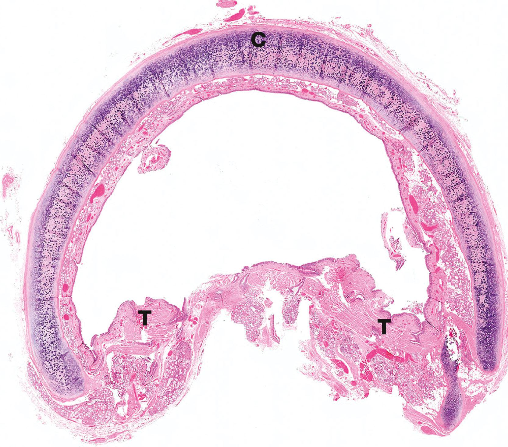 Fig. 12.6, Trachea
