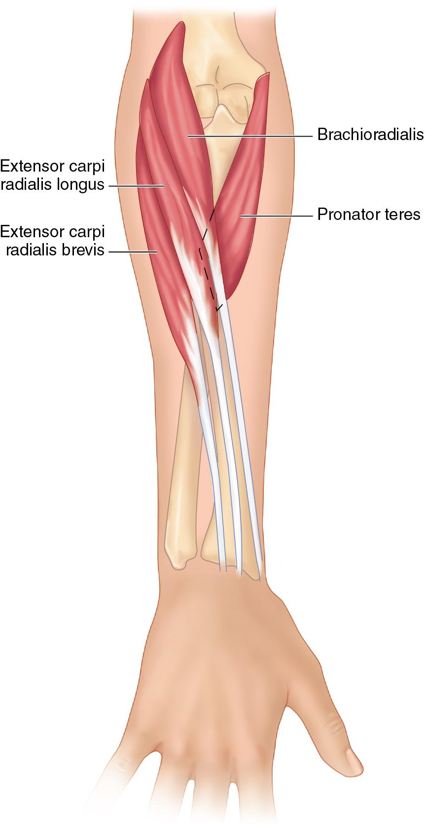 FIGURE 71.1, Surgical anatomy.