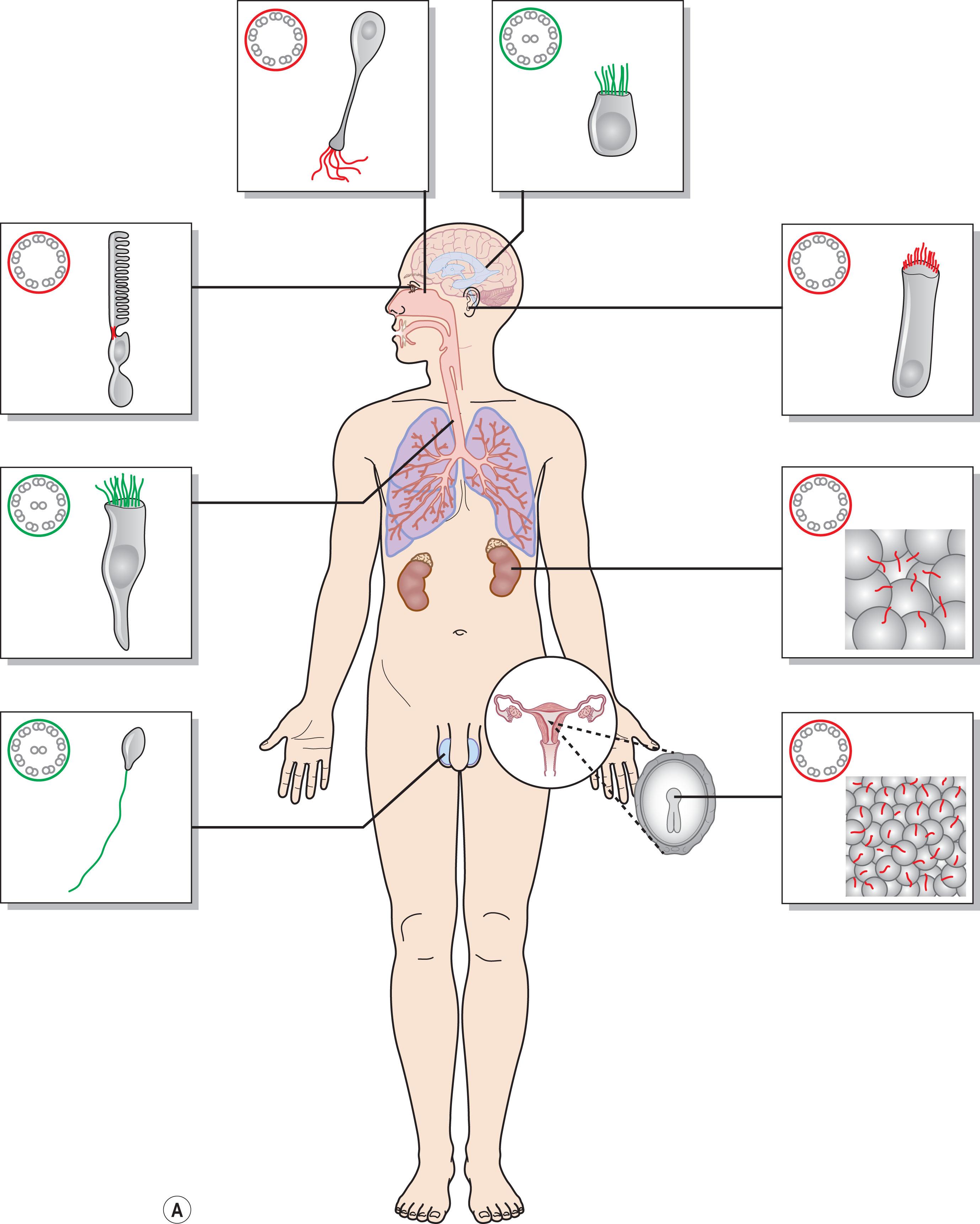 Fig. 46.2, Ciliopathies. (A) Schematic representation of cilia in various cells in the human. In green: motile cilia; in red: primary cilia. Continued overleaf.Fig. 46.2, cont’d (B) Schematic representation as an abacus (adding various target organs) of syndromes recognized as ciliopathies.