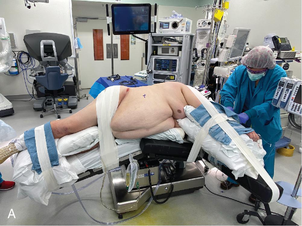 Fig. 20.1, Patient Positioning.