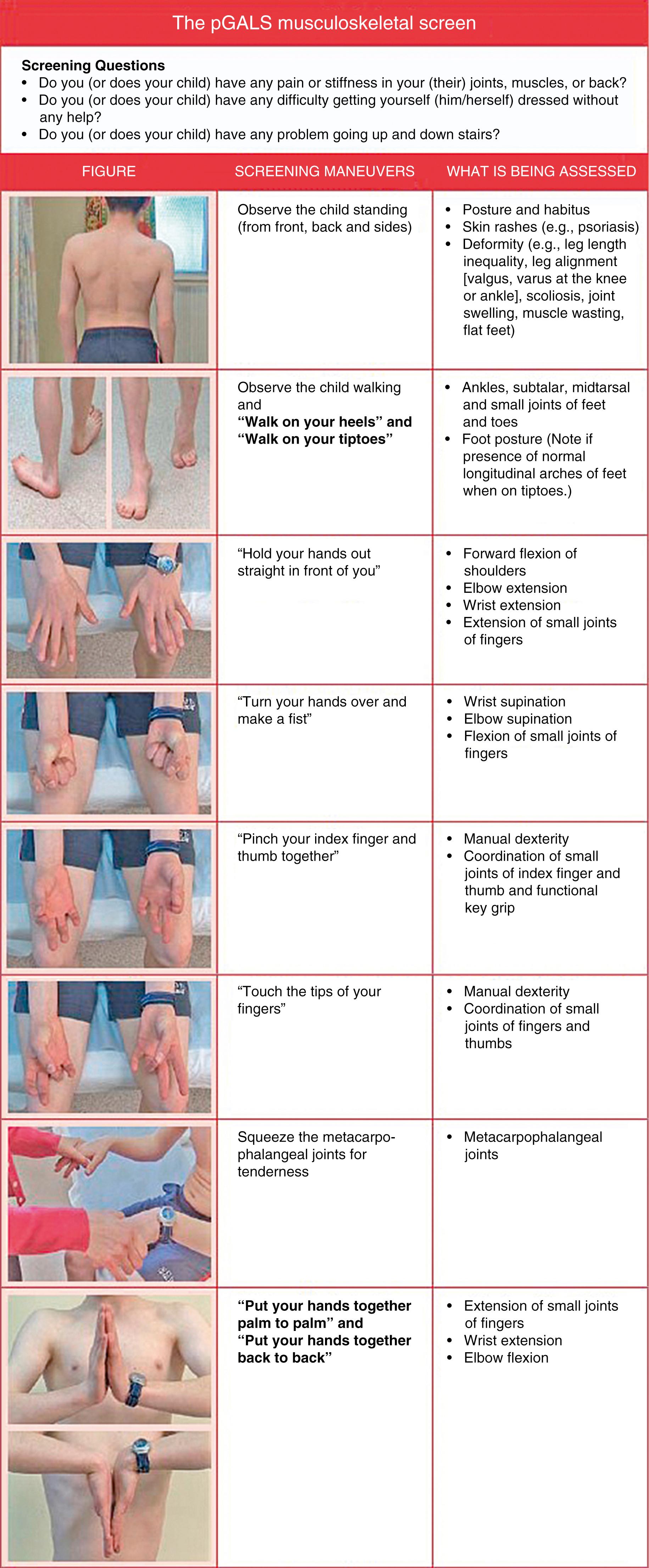 Fig. 7.1, The pediatric G ait, A rms, L egs, S pine (pGALS) musculoskeletal screen.