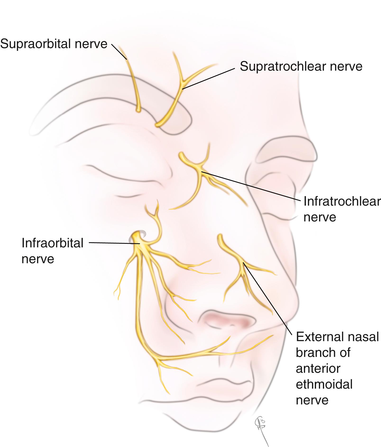 Fig. 68.4, Sensory nerve supply of the external nose.
